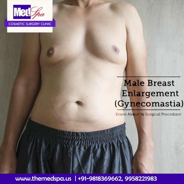 Gynecomastia Surgery for Male Breast Reduction