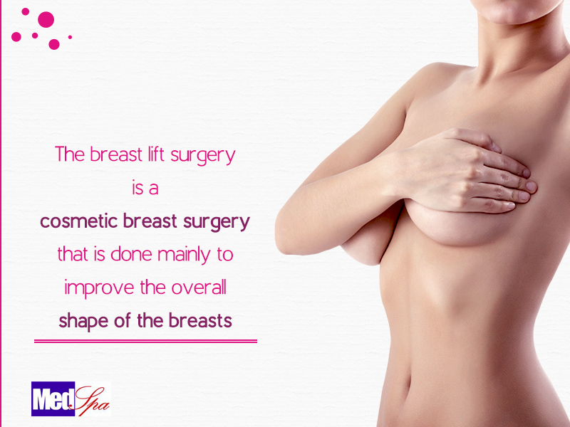 Breast Lift Surgery for Better Proportionate Breast Contours